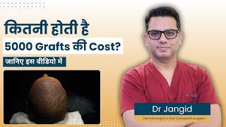 How Much Does 5000 Hair Grafts Cost  Find Out from a Hair Transplant Surgeon  Dr Jangid [upl. by Elicul]