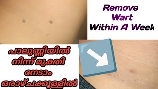 Palunni treatment malayalam ll Wart removal ll SkinTags ll അരിമ്പാറ പാലുണ്ണി 10 ദിവസം കൊണ്ട് മാറ്റാം [upl. by Edasalof480]