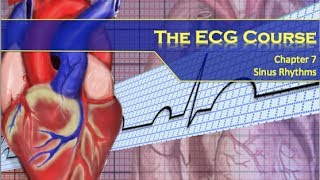 The ECG Course  Sinus Rhythms [upl. by Cyrie198]