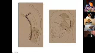 Versatility and Variability of Middle Fossa Approaches [upl. by Bull997]