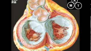 Animated Mitral Regurgitation Murmur [upl. by Esdnil7]