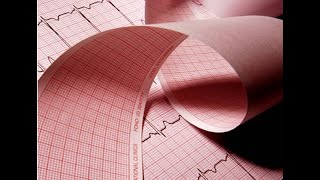 Electrocardiogram Characteristics of the ECG paper Standarization Papel de ECG Estandarización [upl. by Gadmann]