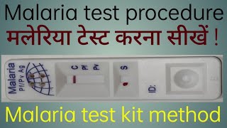 Malaria test kit method  Malaria test procedure  Malaria test kaise kiya jata hai [upl. by Iaht309]