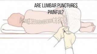 Lumbar Puncture experience [upl. by Avis]