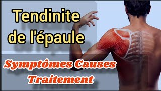 Tendinite de lépaule Causes symptômes traitement efficace Soulager Exercices coiffe des Rotateurs [upl. by Brenden943]