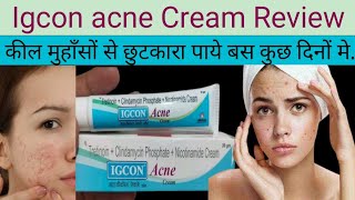 Igcon Acne Cream ke Fayde Igcon Acne Cream Uses in Hindi [upl. by Drucie]