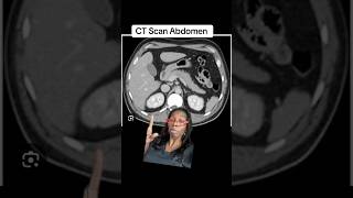 The Truth Revealed What a CT Scan of the Abdomen Shows [upl. by Zetnas]