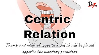 How to Determine Centric Relation PROSTHODONTICS [upl. by Nonac]