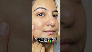 😮How To Treat Acne Pimples ✅🌸acne pimple oilyskin youtubeshorts [upl. by Worsham]