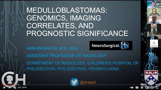 Medulloblastomas Genomics Imaging correlates and Prognostic Significance [upl. by Cyna231]