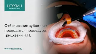 Отбеливание зубов  как проводится процедура что такое quotбелаяquot диета [upl. by Otha358]