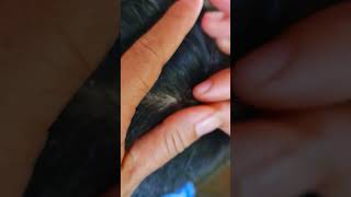 Itchy Scalp Satisfying And Picking Lice hair closure baby closuresewin hairextensions [upl. by Wilden]