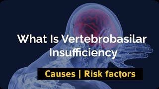 What Is Vertebrobasilar Insufficiency  Causes  Risk factors [upl. by Inessa]