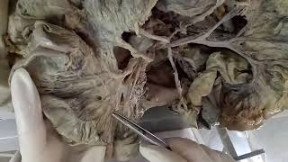 INTESTINES  BY DR MITESH DAVE [upl. by Sumetra]