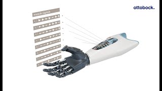 Ottobock Myo Plus pattern recognition The AI control for myoelectric arm prostheses  Ottobock [upl. by Dichy562]