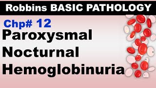 Ch12  Paroxysmal Nocturnal Hemoglobinuria  Blood Pathology  Dr Asif Lectures [upl. by Duhl]