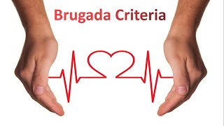 Brugada Criteria for VT vs SVT I ECG Made Super Easy [upl. by Aicirt857]