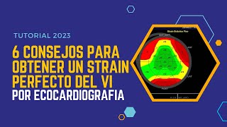 🚀Seis consejos para obtener un 💪STRAIN PERFECTO por ECOCARDIOGRAFÍA [upl. by Ahcsim]