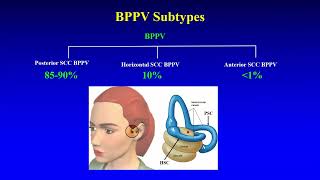 BPPV  Preliminary Insights [upl. by Terrej]