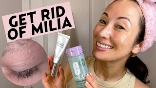 Get Rid of Milia With This Nighttime Skincare Routine Removal amp Treatment Tips  Susan Yara [upl. by Htebasyle]