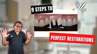 Indirect Restorations 9 steps to Success [upl. by Nylimaj]