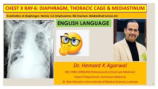 Radiology Chest X Ray6 ENGLISH Diaphragm Chest wall and MediastinumDr Hemant K Agarwal [upl. by Enialedam675]