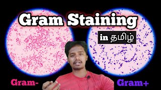 Gram Staining in தமிழ்  QampA 3  Vasanth Murugesan [upl. by Tubb]