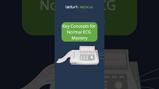 Key Concepts of ECG Explained by Santiago usmle [upl. by Ranchod]