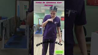 Abnormal Gait Pattern hemiplegia medical doctor physio viralvideo [upl. by Rhynd]