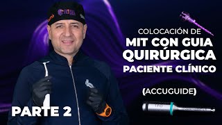 COLOCACIÓN DE MIT CON GUIA QUIRÚRGICA ACCUGUIDE  DR DOUGLAS ESCOBAR [upl. by Reniar]