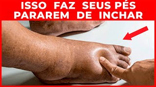 Remédios caseiros para pés inchados  Remédios Naturais para Edema [upl. by Anecuza]