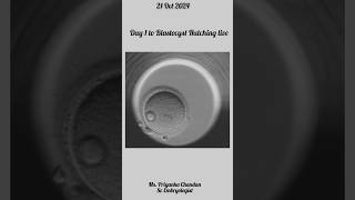 IVF Embryo Development Day by Day🧿🔬embryoculture embryologist [upl. by Meyer593]