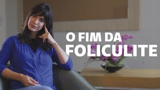 3 dicas infalíveis para evitar a foliculite  Viver Bem [upl. by Aitnuahs]