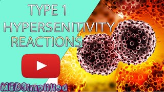 Hypersensitivity Type 1 Reactions Made Easy Type 1 Allergic Reaction [upl. by Yemar]