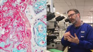 Microscope tutorial  Troubleshooting the MSB stain [upl. by Jasmina71]