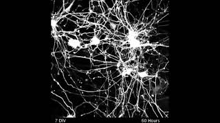 Neuron Connectivity Time Lapse [upl. by Teyut]