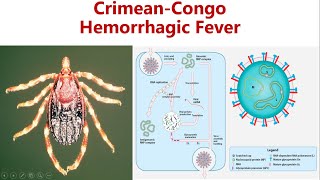 CrimeanCongo Hemorrhagic fever  CCHF  Cause Symptoms Diagnosis amp Prevention of CCHF [upl. by Dagmar]