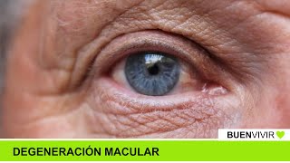 DEGENERACIÓN MACULAR  Consultorio Nítido  BUENVIVIR💚 071024 Canal 4 [upl. by Antonius]