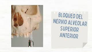 Tecnicas de Anestesia Maxilar y Mandibular [upl. by Clayborn]