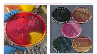 الكشف عن بكتريا الشيجلا Detection of Shigella bacteria [upl. by Wulf719]