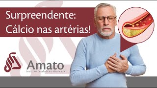 Surpreendente Verdade Sobre a Calcificação nas Artérias a Aterosclerose [upl. by Sondra]