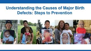 Understanding the Causes of Major Birth Defects Steps to Prevention [upl. by Alletniuq343]