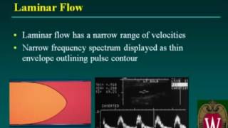 Carotid Sonography Doppler Evaluation and Waveform Analysis [upl. by Gerianne846]