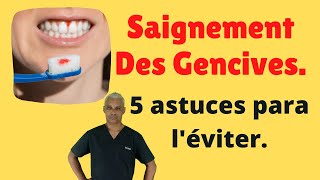 Saignement des gencives  traitement gingivite  5 astuces para léviter [upl. by Ades324]