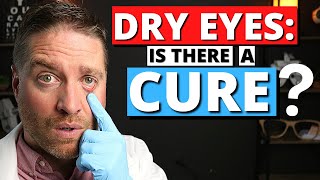 DRY EYES Is There A Cure  Dry Eye Syndrome Explained [upl. by Basham]