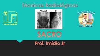 Radiografia do Sacro  AP axial e Perfil [upl. by Nylisoj]