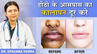 How to Remove Pigmentation Around the Mouth Upasana Ki Duniya [upl. by Gabler]