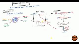 Diabetes Mellitus Type 1 for USMLE Step1 and USMLE Step 2 [upl. by Llenrod]