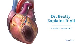 Dr Beatty Explains It All Heart Attack  Visible Body [upl. by Desdamona461]