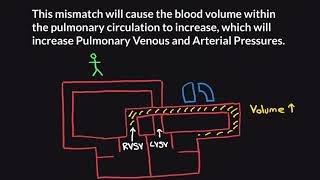 Pulmonary Hypertension Part 1 [upl. by Larok]